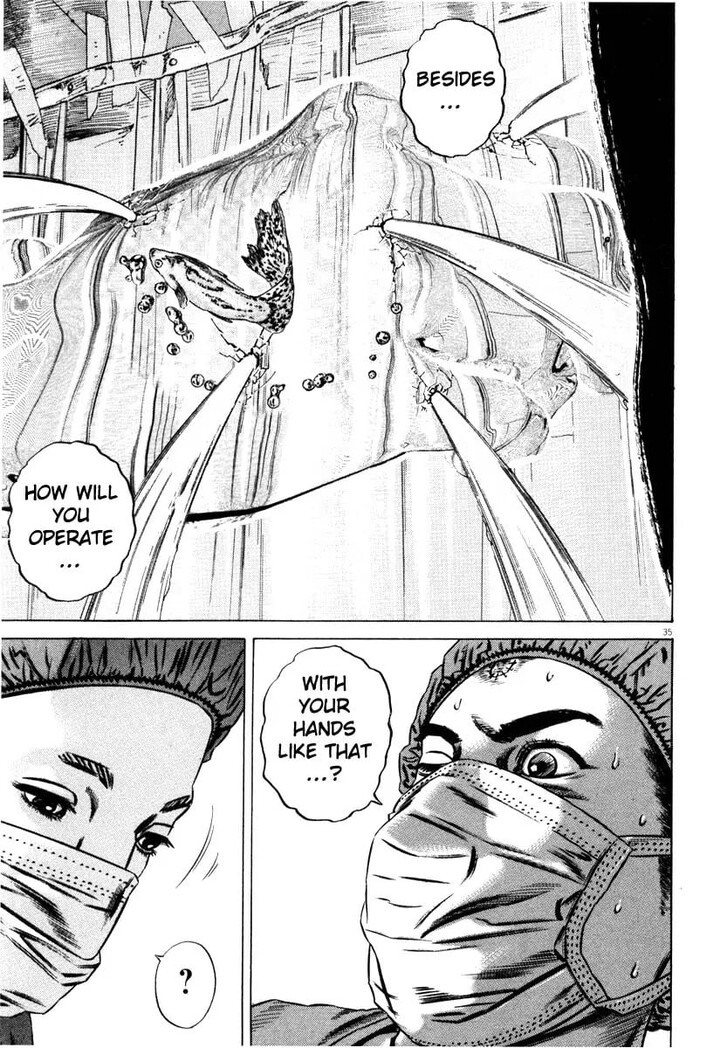 Read Homunculus Manga Online