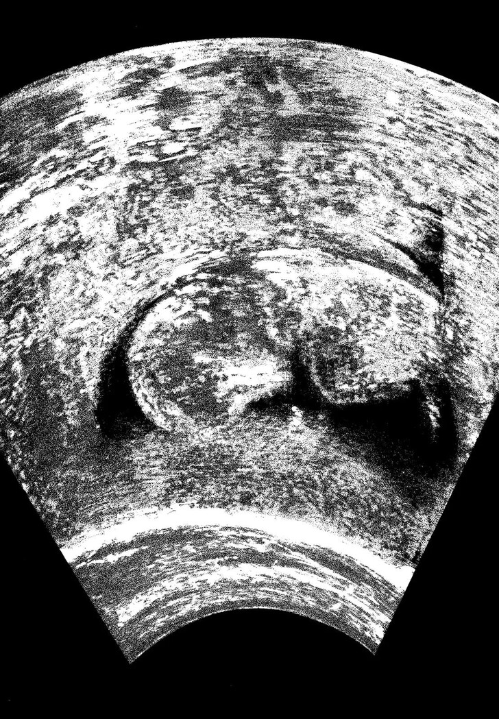 Read Homunculus Manga Online